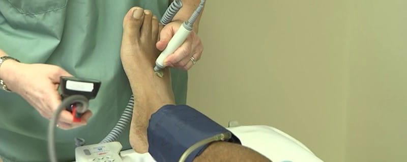 patient receiving PAD therapy on leg